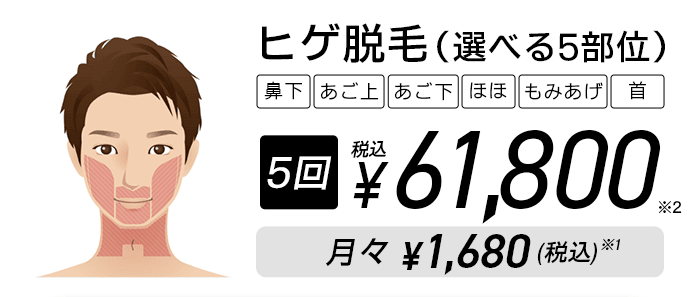 メンズエミナルの新設キャンペーン ヒゲ脱毛（選べる5部位）の料金