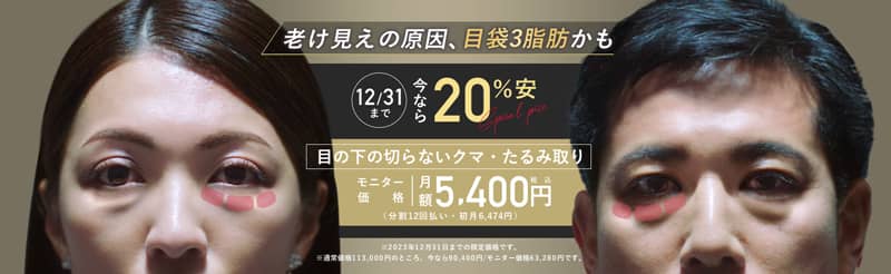 湘南美容クリニックの目袋3脂肪 期間限定20%オフ割引キャンペーン