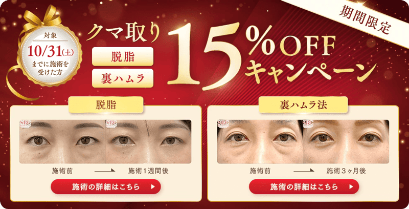 SBCスキンクリニックのクマ取り 期間限定15%OFFキャンペーン